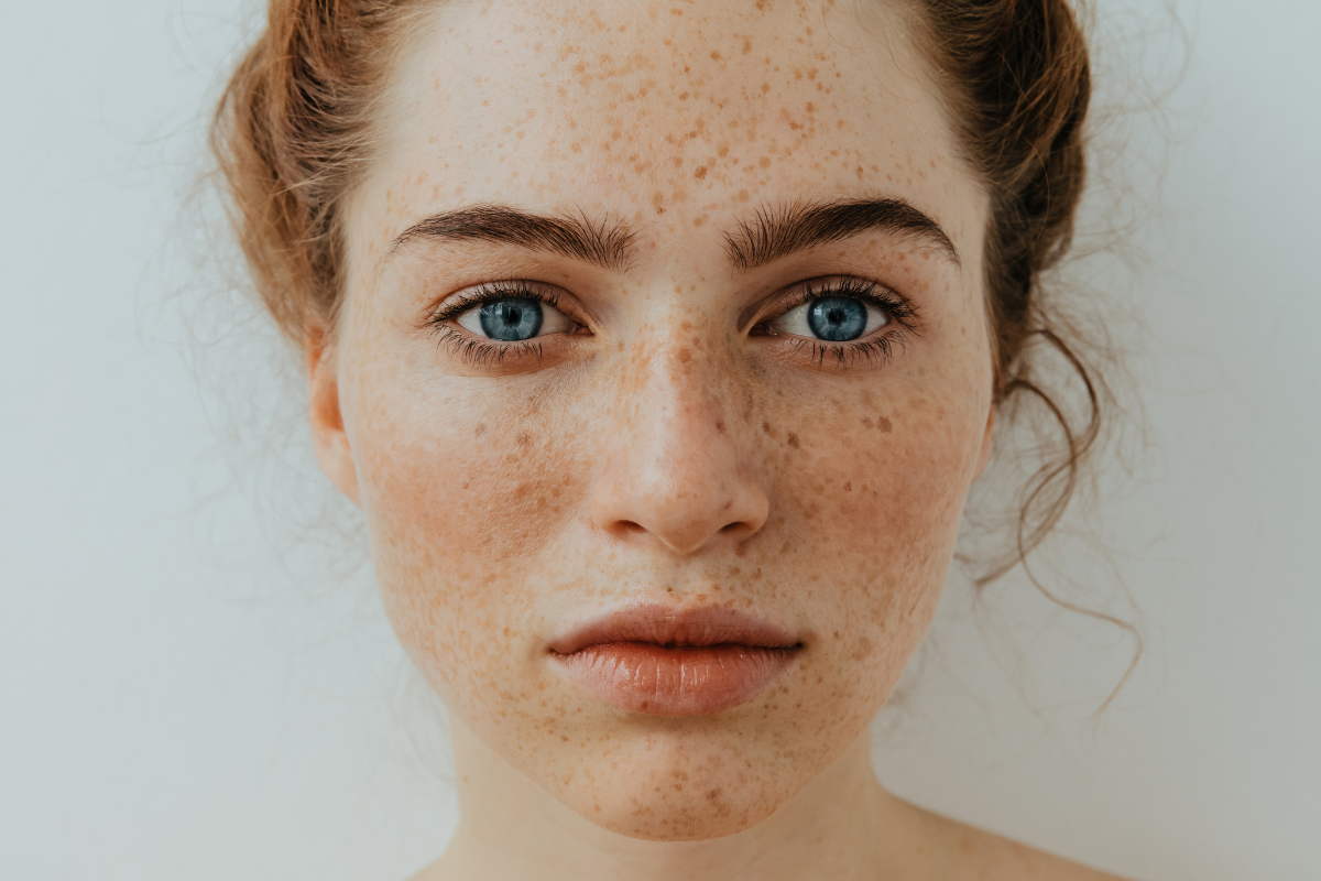 Top 4 Tips to Treat Dry Skin Naturally