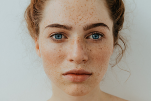Top 4 Tips to Treat Dry Skin Naturally